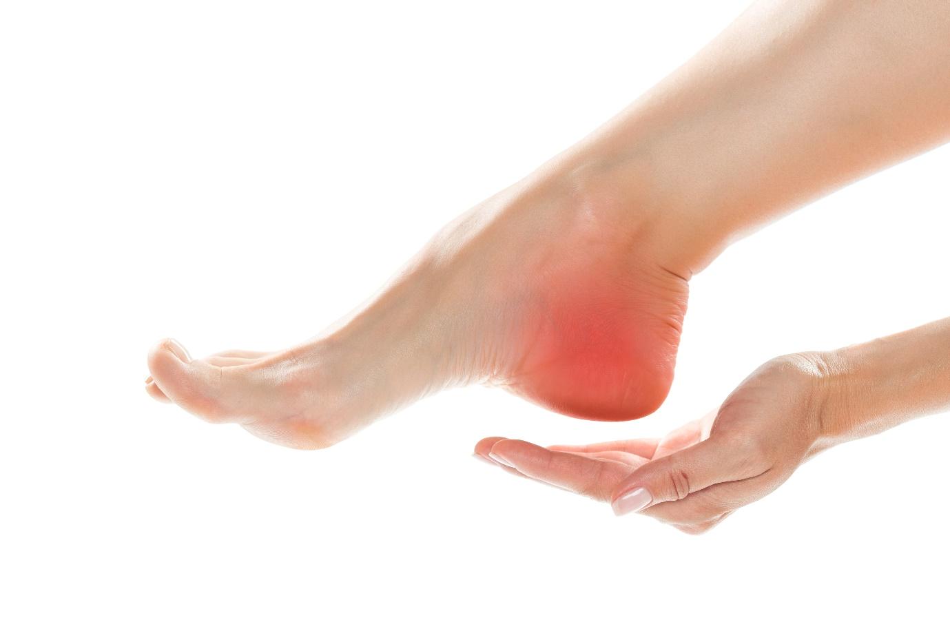 Heel spur causing heel pain